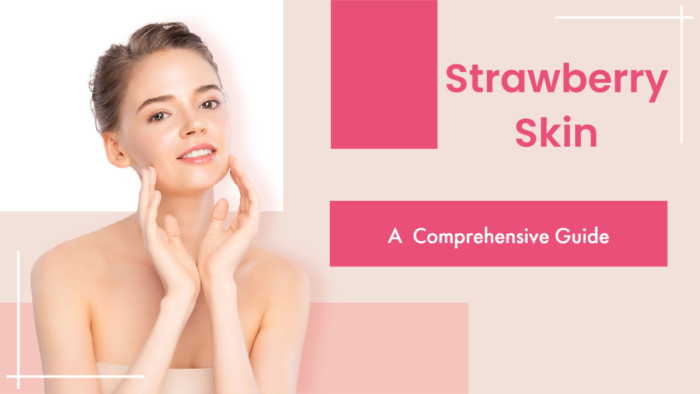 Strawberry Skin: A Comprehensive Guide, its causes and prevention
